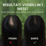 Șampon Solid Natural cu Plante | Mătreață Severă și Căderea Părului