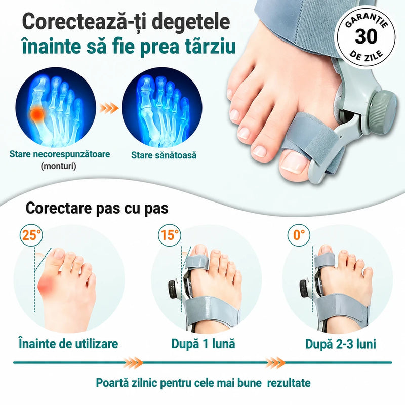Aparat Reglabil Corectare Monturi | MontFix 2