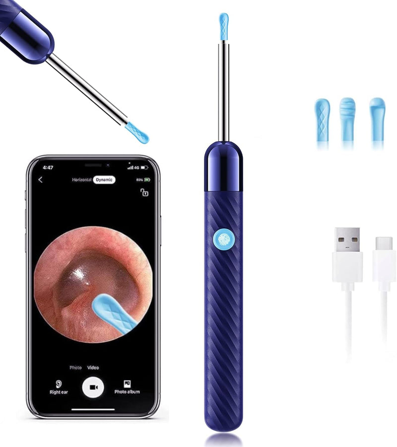 CamMicroscop pentru Urechi cu Cameră HD – Curățare Sigură și Vizualizare în Timp Real